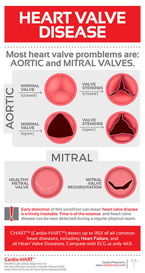 Heart Valve Disease: Aortic and Mitral