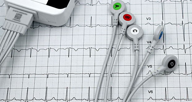 What can a ECG say about your health...