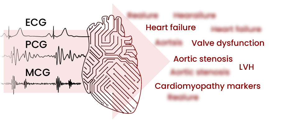 Combined ECG, MCG and PCG signals to detect cardiovascular diseases