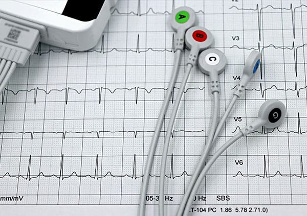 ECG ECG