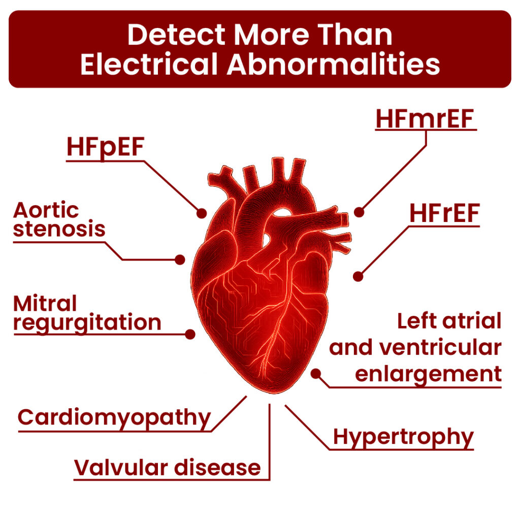 Cardio-HART Detect more than electrical abnormalities