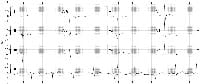 ECG Findings