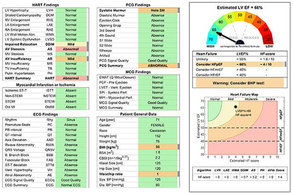 Aortic stenosis Hart findings, PCG, MCH, HF