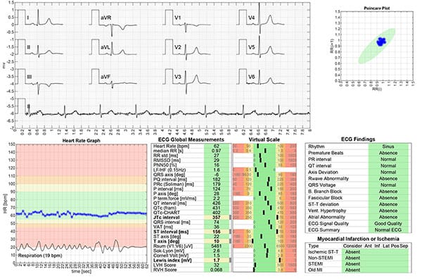 Aortic stenosis