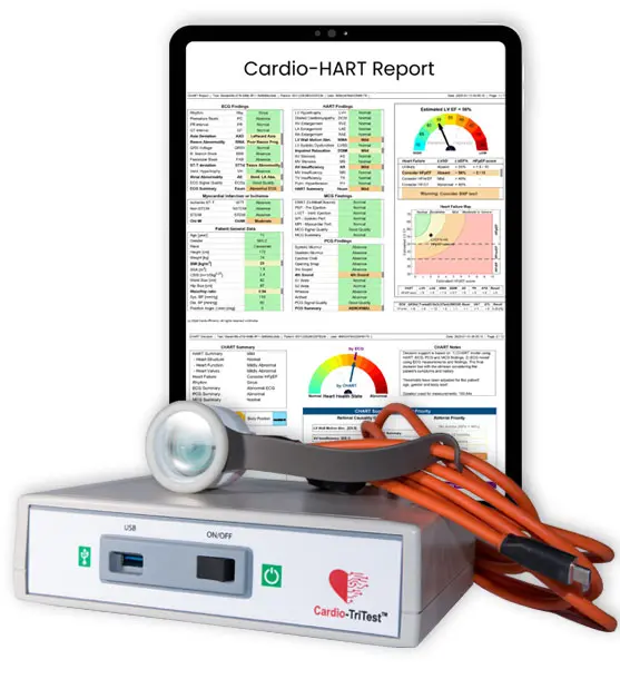 Cardio-HART Report – AI Cardiac Diagnostic Device Cardio-HART Ai heart diagnostic