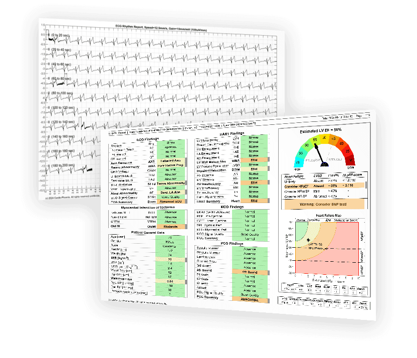 Compare ECG and Cardio-HART AI Heart Diagnostic ECG vs Cardio-HART AI heart diagnostic report comparison