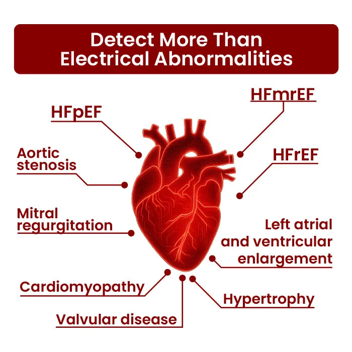 Cardio-HART for Physicians detects more than electrical abnormalities including HFpEF, HFrEF, valve disease, and hypertrophy