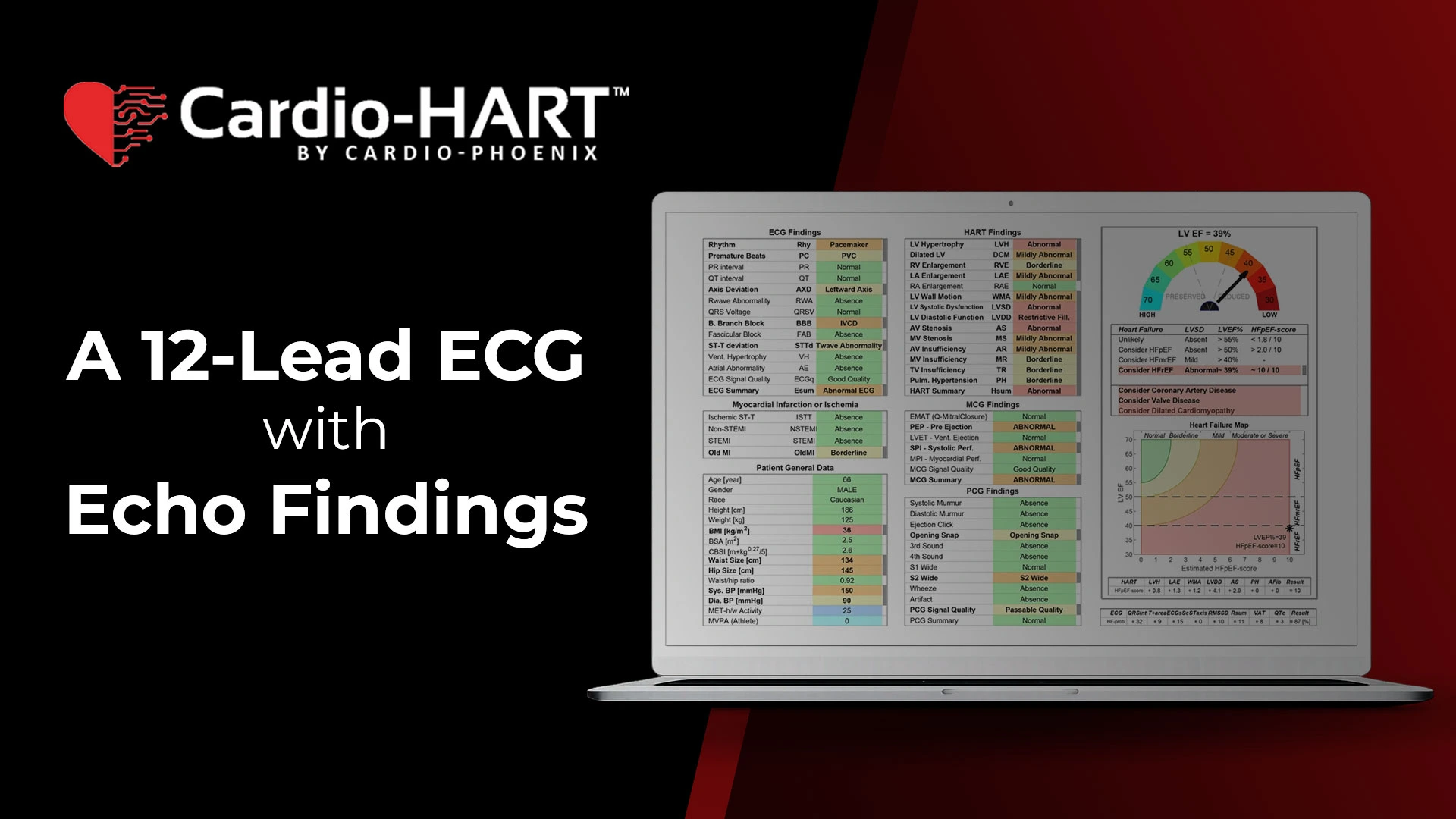 Breakthrough Cardiac Diagnostic System | Cardio-HART