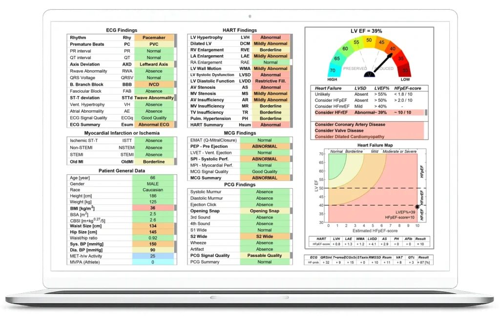 Cardio-HART diagnostic report showing ECG, HART, MCG, and PCG findings with LV ejection fraction and heart failure risk assessment.